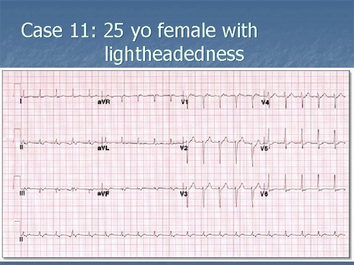 Case 11: 25 yo female with lightheadedness 