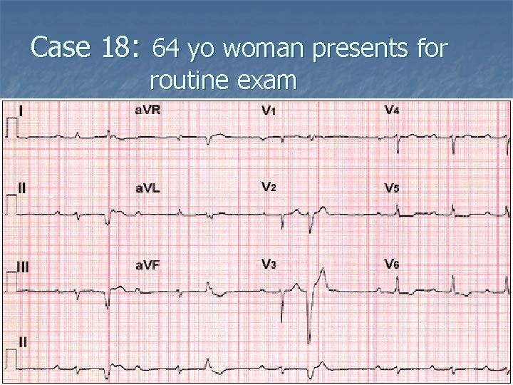 Case 18: 64 yo woman presents for routine exam 