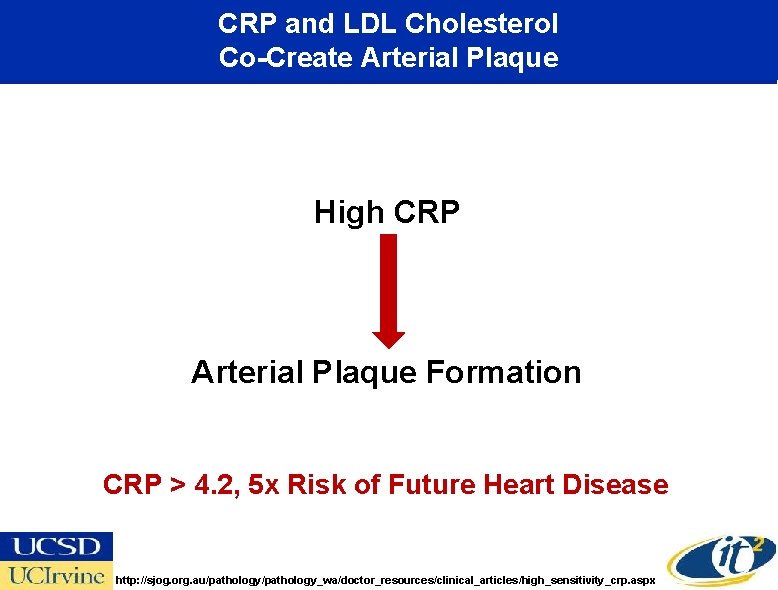 CRP and LDL Cholesterol Co-Create Arterial Plaque High CRP Arterial Plaque Formation CRP >