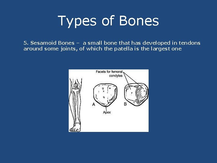 Types of Bones 5. Sesamoid Bones – a small bone that has developed in