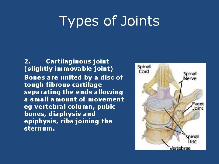 Types of Joints 2. Cartilaginous joint (slightly immovable joint) Bones are united by a