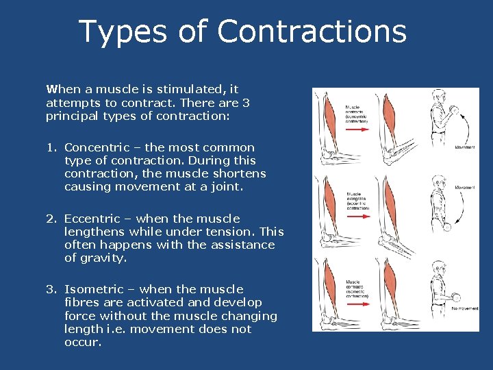 Types of Contractions When a muscle is stimulated, it attempts to contract. There are