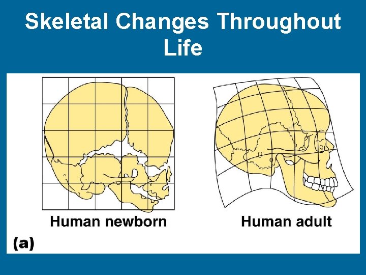 Skeletal Changes Throughout Life Figure 5. 33 a 