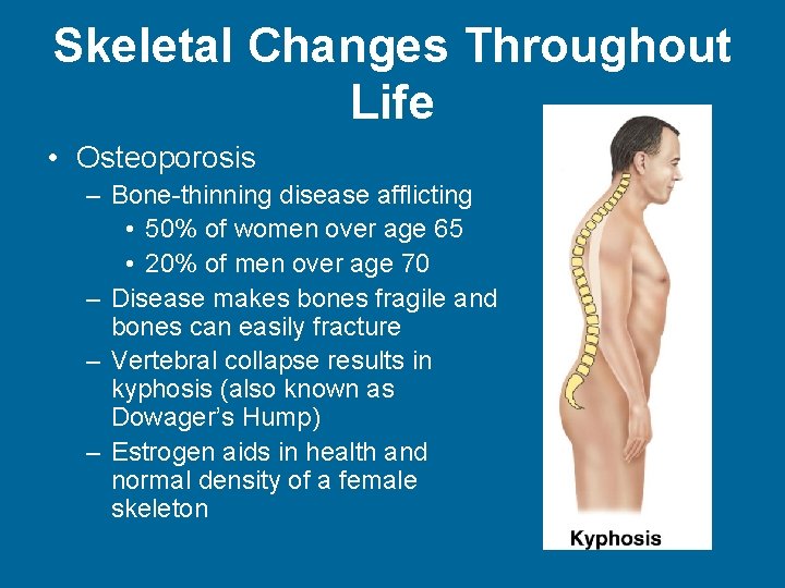 Skeletal Changes Throughout Life • Osteoporosis – Bone-thinning disease afflicting • 50% of women