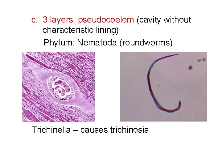 c. 3 layers, pseudocoelom (cavity without characteristic lining) Phylum: Nematoda (roundworms) Trichinella – causes