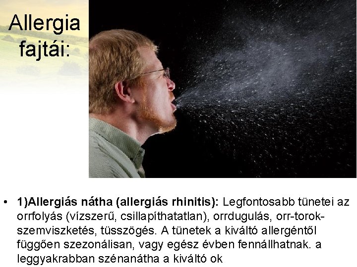 Allergia fajtái: • 1)Allergiás nátha (allergiás rhinitis): Legfontosabb tünetei az orrfolyás (vízszerű, csillapíthatatlan), orrdugulás,