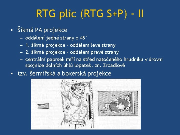 RTG plic (RTG S+P) - II • Šikmá PA projekce – – oddálení jedné