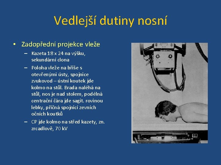Vedlejší dutiny nosní • Zadopřední projekce vleže – Kazeta 18 x 24 na výšku,