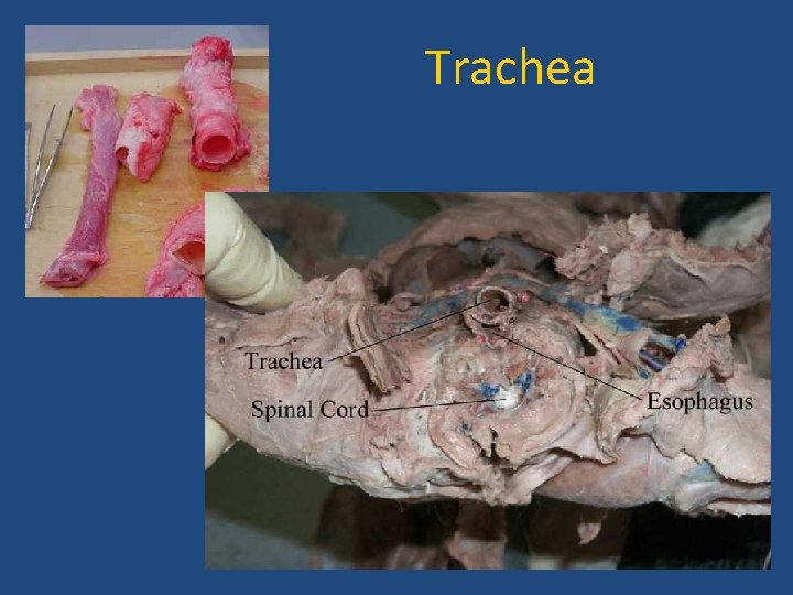Trachea 