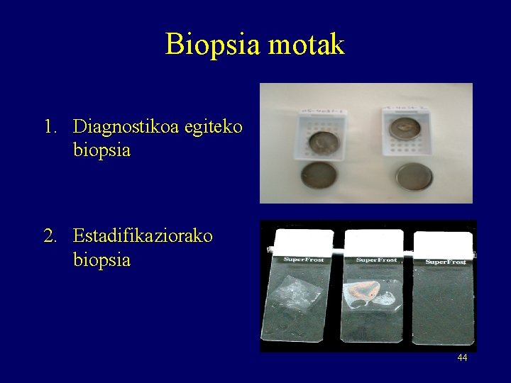 Biopsia motak 1. Diagnostikoa egiteko biopsia 2. Estadifikaziorako biopsia 44 