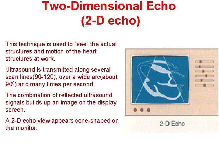 Two-Dimensional Echo (2 -D echo) This technique is used to "see" the actual structures