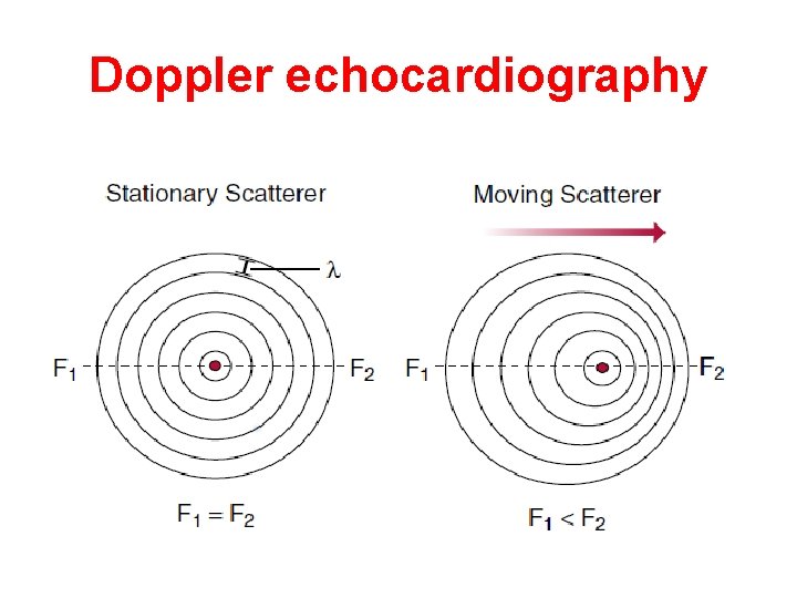 Doppler echocardiography 