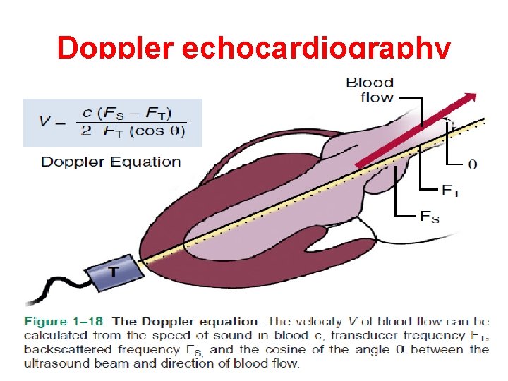 Doppler echocardiography 