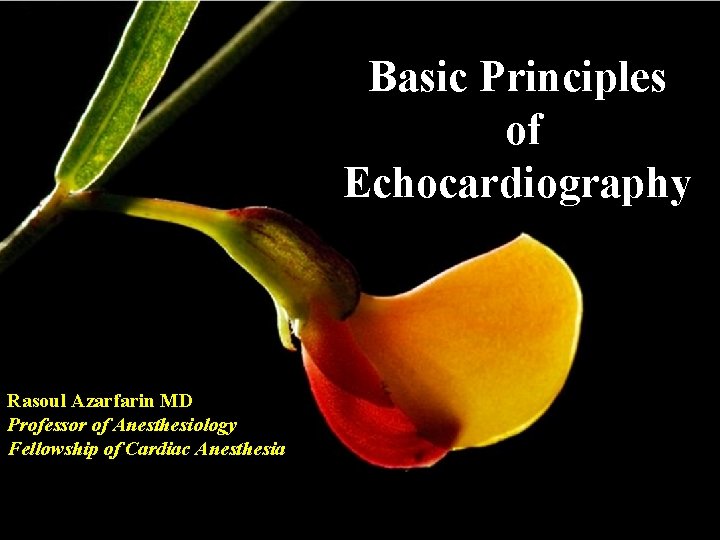 Basic Principles of Echocardiography Rasoul Azarfarin MD Professor of Anesthesiology Fellowship of Cardiac Anesthesia