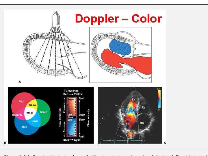 Doppler – Color 