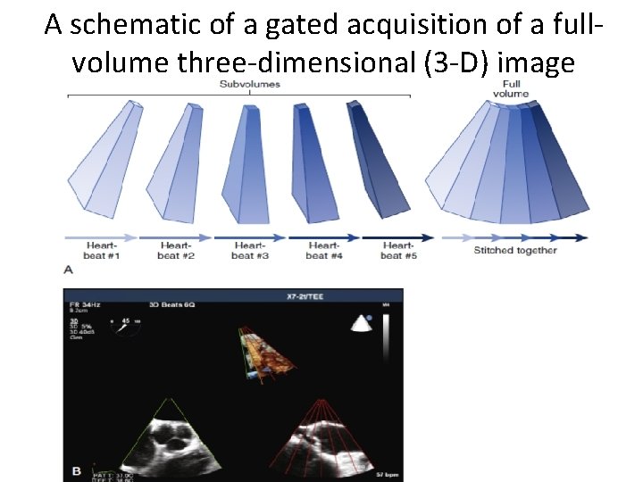 A schematic of a gated acquisition of a fullvolume three-dimensional (3 -D) image 