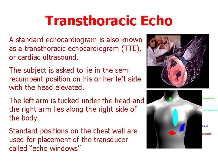 Transthoracic Echo A standard echocardiogram is also known as a transthoracic echocardiogram (TTE), or
