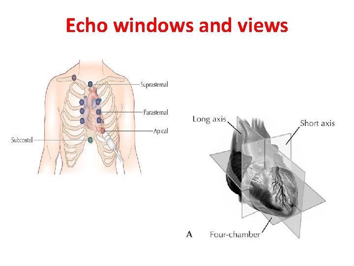 Echo windows and views 