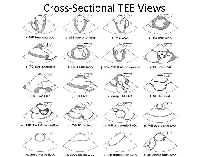 Cross-Sectional TEE Views 