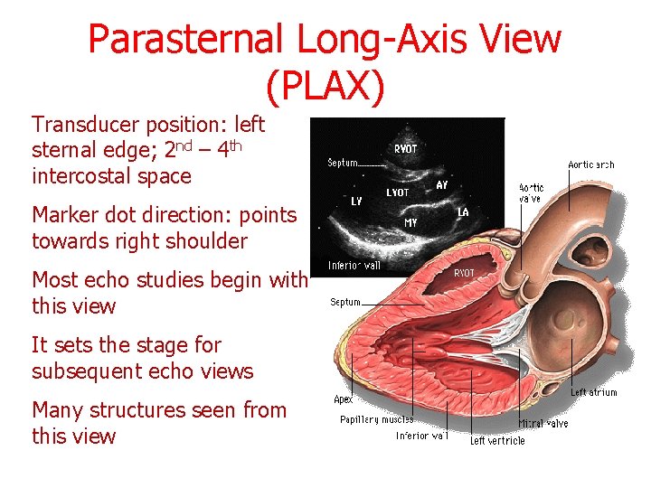 Parasternal Long-Axis View (PLAX) Transducer position: left sternal edge; 2 nd – 4 th