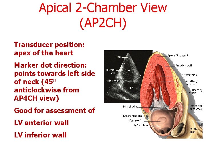 Apical 2 -Chamber View (AP 2 CH) Transducer position: apex of the heart Marker