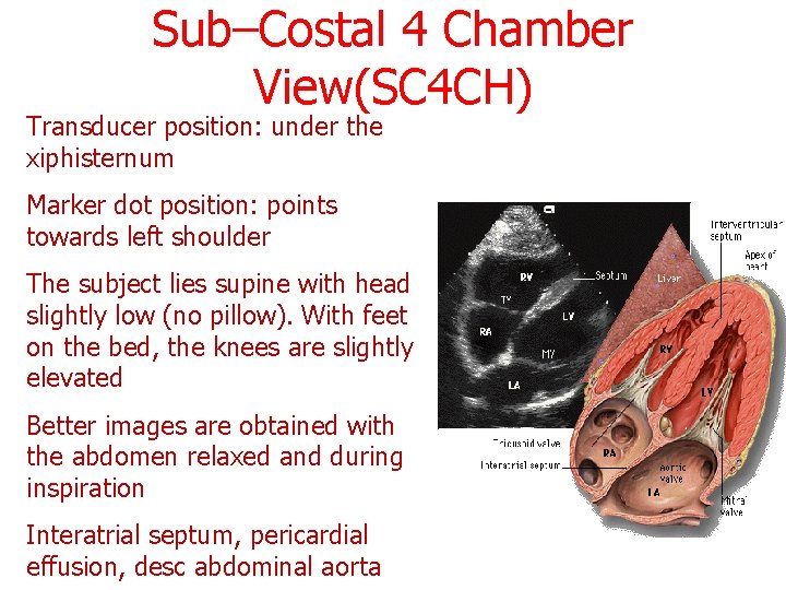 Sub–Costal 4 Chamber View(SC 4 CH) Transducer position: under the xiphisternum Marker dot position: