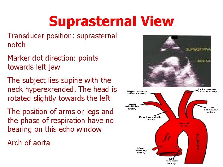 Suprasternal View Transducer position: suprasternal notch Marker dot direction: points towards left jaw The