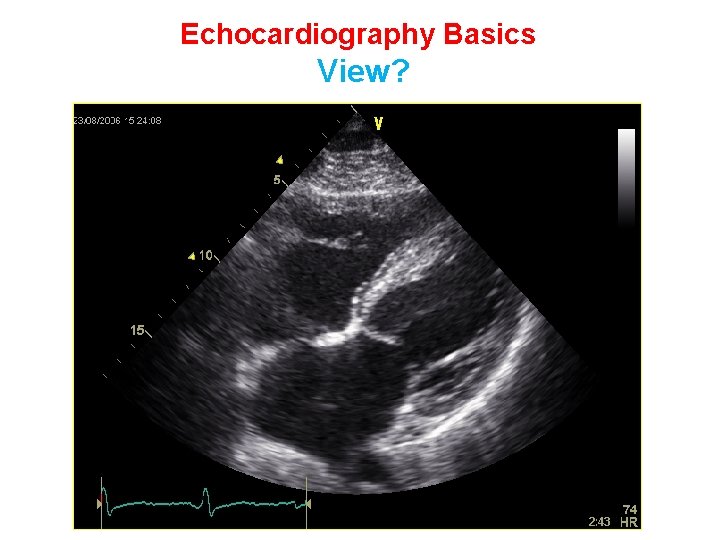 Echocardiography Basics View? 
