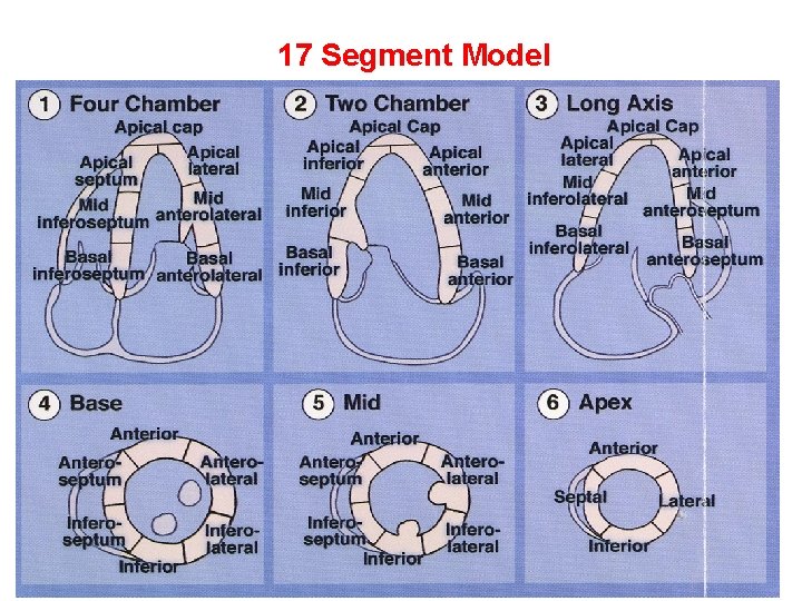 17 Segment Model 