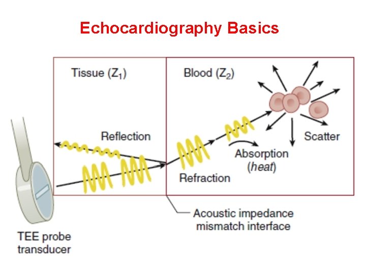 Echocardiography Basics Ultrasound waves sent from chest wall 
