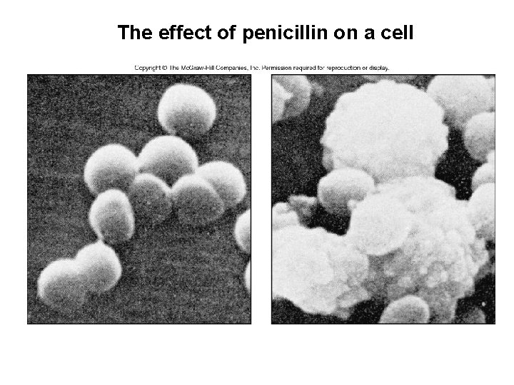 The effect of penicillin on a cell 