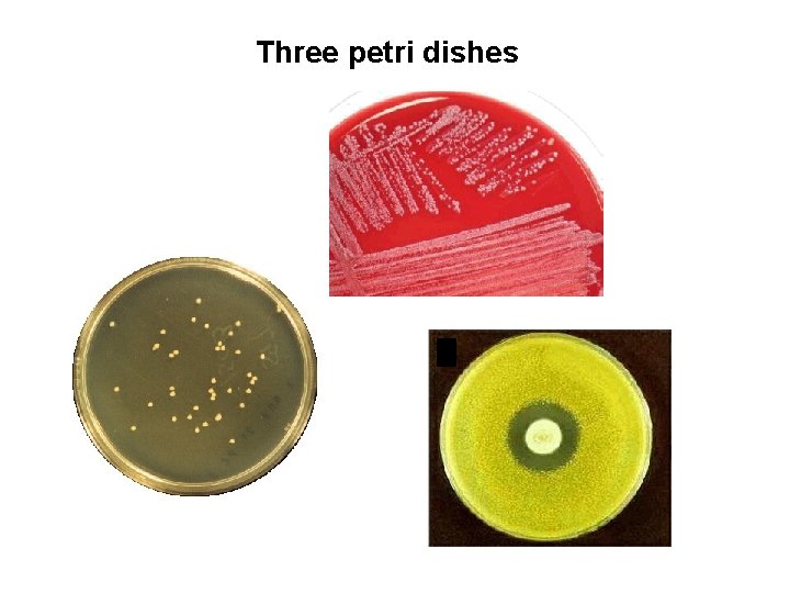 Three petri dishes 