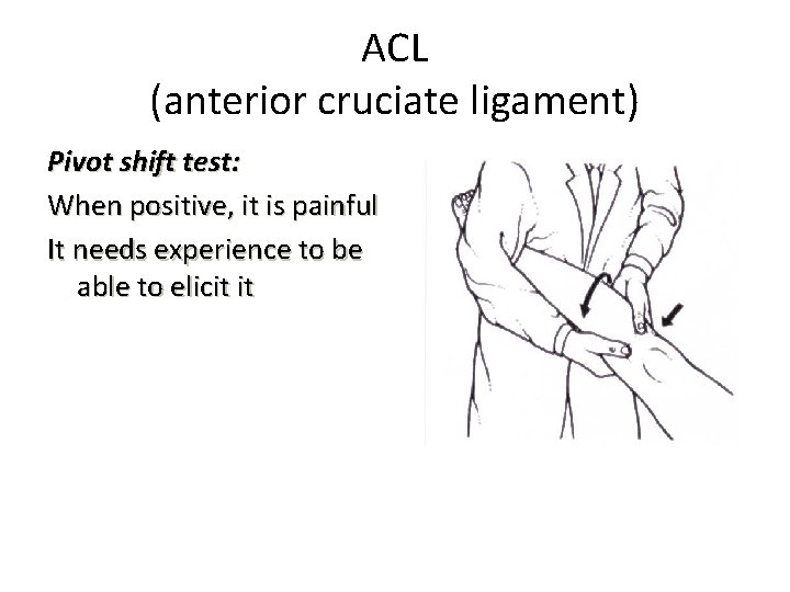 ACL (anterior cruciate ligament) Pivot shift test: When positive, it is painful It needs