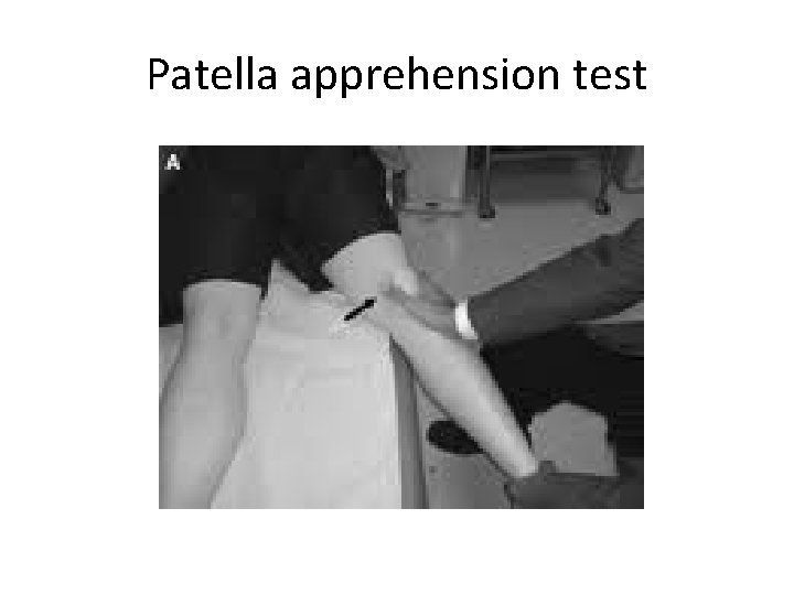 Patella apprehension test 
