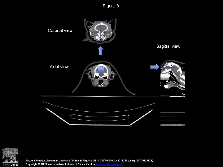Figure 3 Physica Medica: European Journal of Medical Physics 2014 3057 -62 DOI: (10.