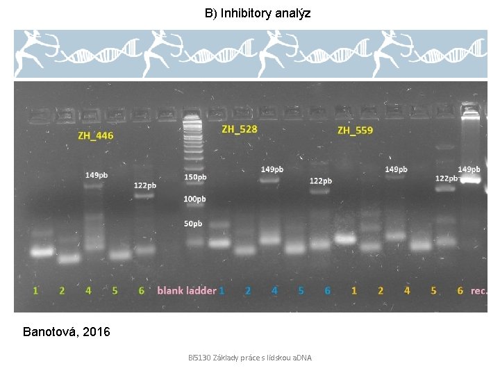 B) Inhibitory analýz Banotová, 2016 Bi 5130 Základy práce s lidskou a. DNA 