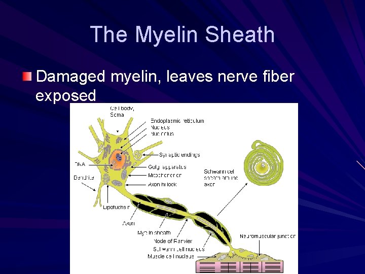 The Myelin Sheath Damaged myelin, leaves nerve fiber exposed 