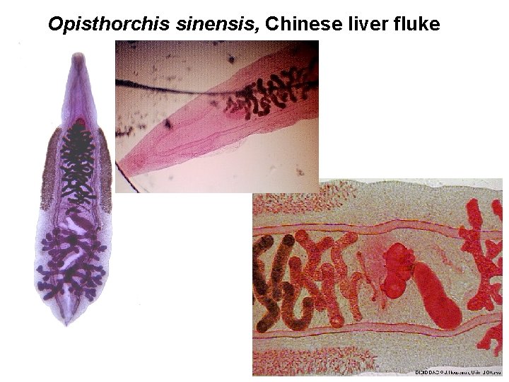 Opisthorchis sinensis, Chinese liver fluke 