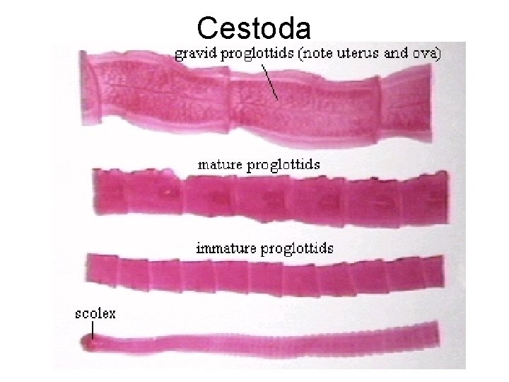 Cestoda 