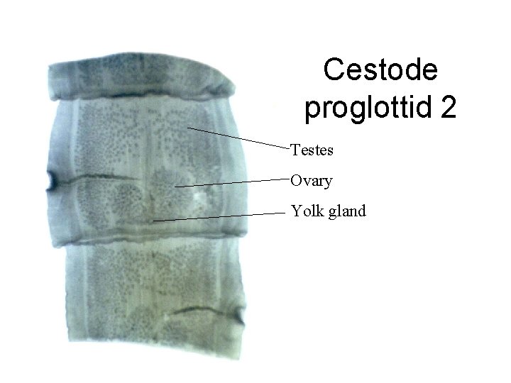 Cestode proglottid 2 Testes Ovary Yolk gland 