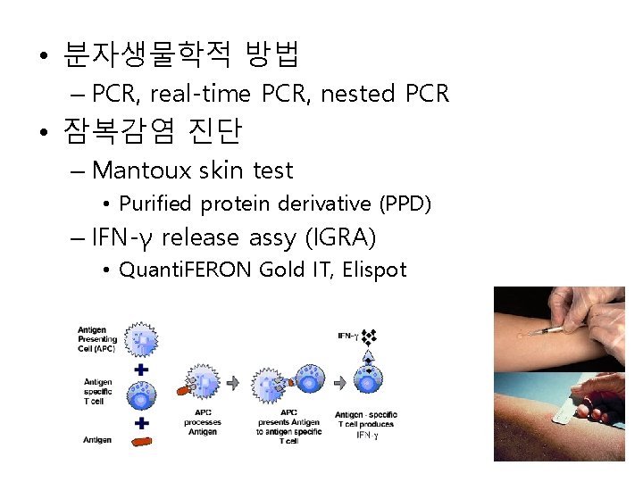  • 분자생물학적 방법 – PCR, real-time PCR, nested PCR • 잠복감염 진단 –