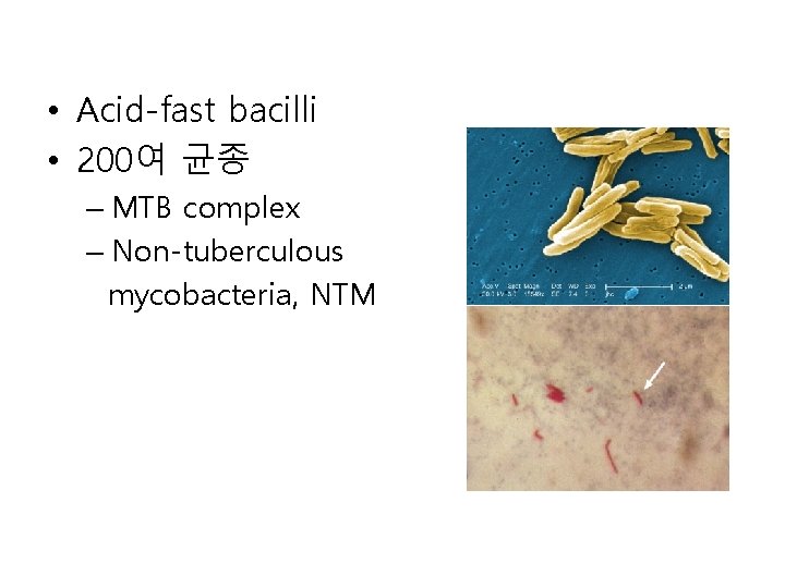  • Acid-fast bacilli • 200여 균종 – MTB complex – Non-tuberculous mycobacteria, NTM