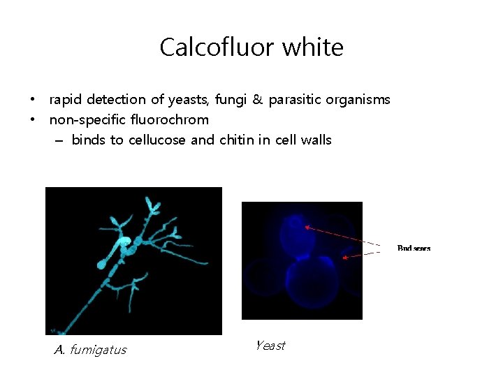 Calcofluor white • rapid detection of yeasts, fungi & parasitic organisms • non-specific fluorochrom