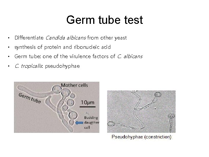 Germ tube test • Differentiate Candida albicans from other yeast • synthesis of protein