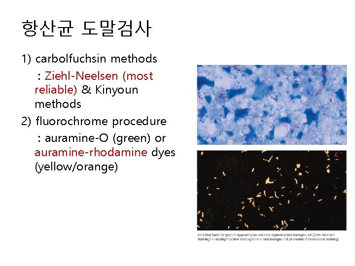 항산균 도말검사 1) carbolfuchsin methods : Ziehl-Neelsen (most reliable) & Kinyoun methods 2) fluorochrome