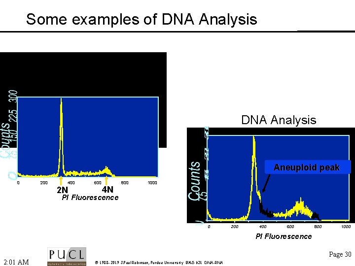 Some examples of DNA Analysis Aneuploid peak 0 200 400 2 N 600 4