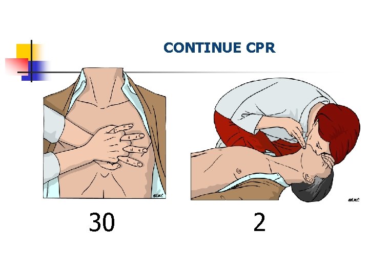 CONTINUE CPR 30 2 