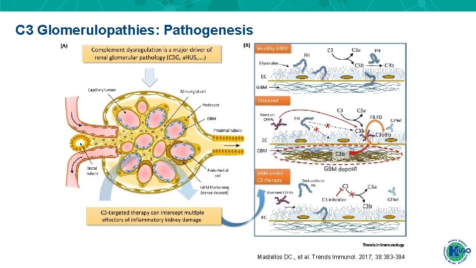 C 3 Glomerulopathies: Pathogenesis Mastellos DC. , et al. Trends Immunol. 2017; 38: 383