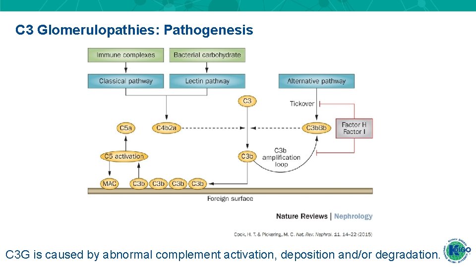 C 3 Glomerulopathies: Pathogenesis C 3 G is caused by abnormal complement activation, deposition