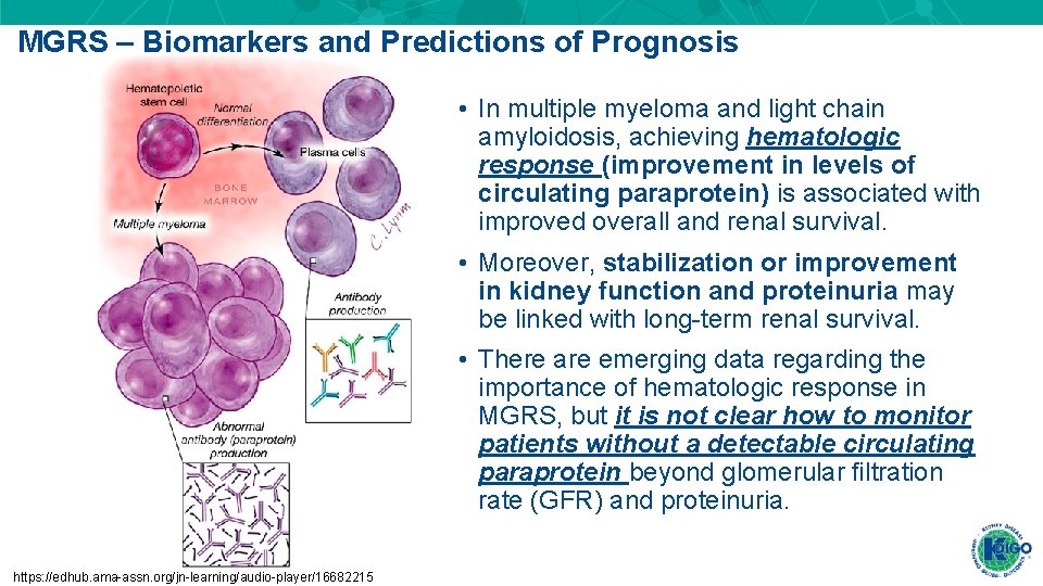 MGRS – Biomarkers and Predictions of Prognosis • In multiple myeloma and light chain